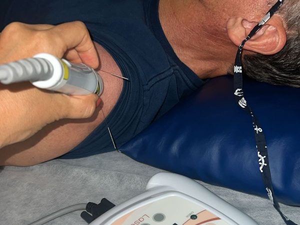 tratamento com laser